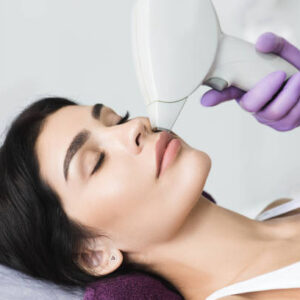 ΑΠΟΤΡΙΧΩΣΗ LASER ALEXANDRITE ΑΝΩ ΧΕΙΛΟΣ